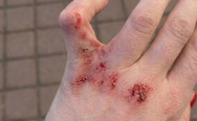 Подросток на электросамокате врезался в женщину в Кудрово