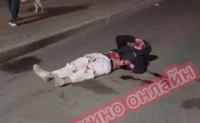 Увезли в реанимацию: легковушка сбила мотоциклиста в Новом Девяткино